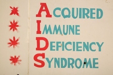 what-causes-aids what causes aids What Causes Aids?