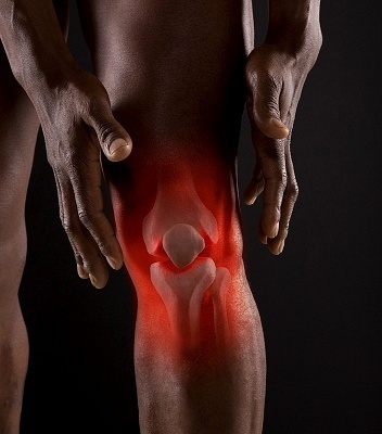what-causes-joint-pain what causes joint pain What Causes Joint Pain?