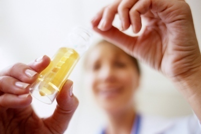 what-causes-protein-in-urine what causes protein in urine What Causes Protein in Urine?